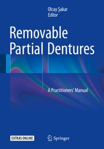 Removable Partial Dentures
