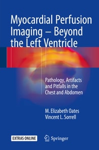 Myocardial Perfusion Imaging - Beyond the Left Ventricle