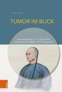 Tumor im Blick