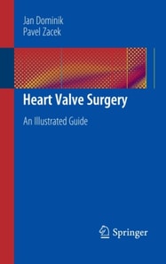 Heart Valve Surgery