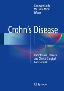 Crohn's Disease