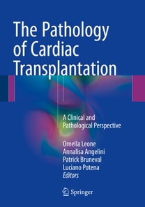 Pathology of Cardiac Transplantation