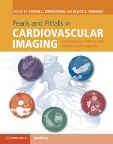 Pearls and Pitfalls in Cardiovascular Imaging