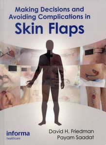 Making Decisions and Avoiding Complications in Skin Flaps