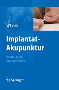 Implantat-Akupunktur