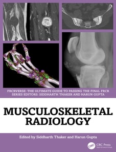 Musculoskeletal Radiology