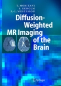 Diffusion-Weighted MR Imaging of the Brain