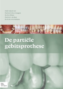 De partiële gebitsprothese