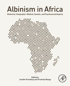 Albinism in Africa