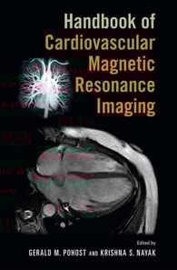 Handbook of Cardiovascular Magnetic Resonance Imaging