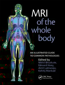 MRI of the Whole Body