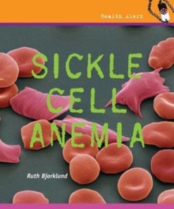 Sickle Cell Anemia