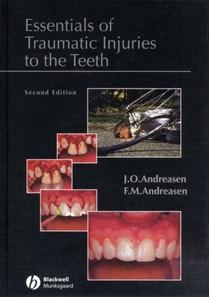 Essentials of Traumatic Injuries to the Teeth