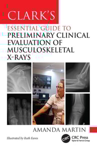 Clark's Essential Guide to Preliminary Clinical Evaluation of Musculoskeletal X-rays
