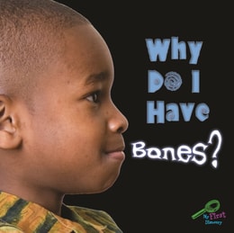 Why Do I Have Bones?
