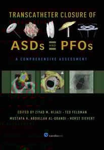 Transcatheter Closure of ASDs and PFOs : A Comprehensive Assessment