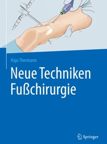 Neue Techniken Fußchirurgie