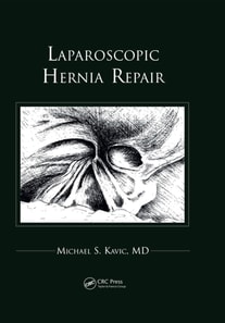 Laparoscopic Hernia Repair