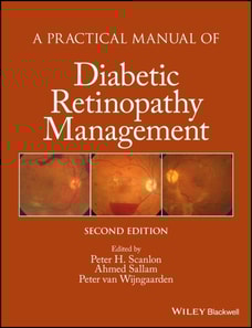 Practical Manual of Diabetic Retinopathy Management