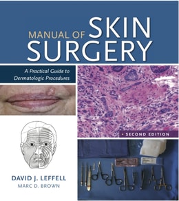 Manual of Skin Surgery