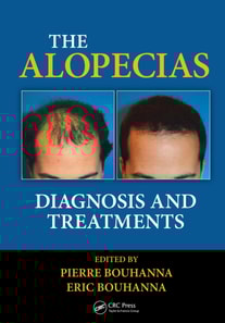 Alopecias
