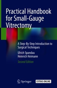 Practical Handbook for Small-Gauge Vitrectomy