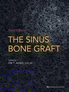 Sinus Bone Graft