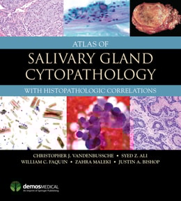 Atlas of Salivary Gland Cytopathology
