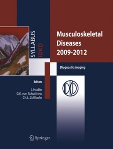 Musculoskeletal Diseases 2009-2012