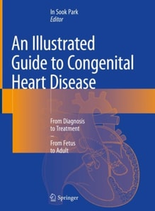 Illustrated Guide to Congenital Heart Disease
