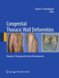 Congenital Thoracic Wall Deformities