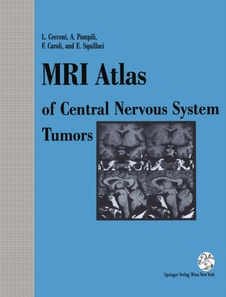 MRI Atlas of Central Nervous System Tumors