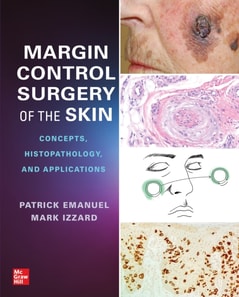 Margin Control Surgery of the Skin: Concepts, Histopathology, and Applications