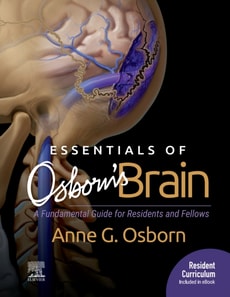 Essentials of Osborn's Brain E-Book