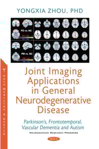 Joint Imaging Applications in General Neurodegenerative Disease