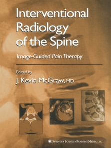 Interventional Radiology of the Spine