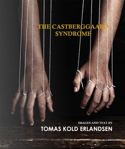 Castberggaard Syndrome