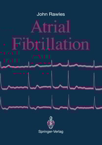 Atrial Fibrillation