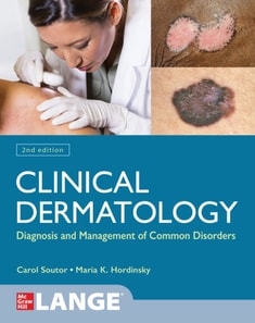 Clinical Dermatology: Diagnosis and Management of Common Disorders, Second Edition