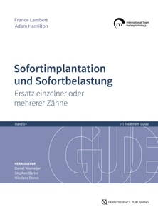 Sofortimplantation und Sofortbelastung