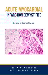 Acute Myocardial Infarction Demystified: Doctor's Secret Guide