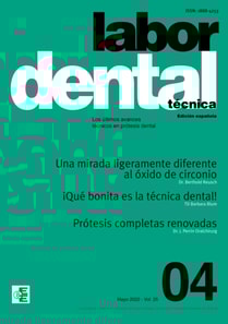 Labor Dental Técnica Nº4 Vol.25
