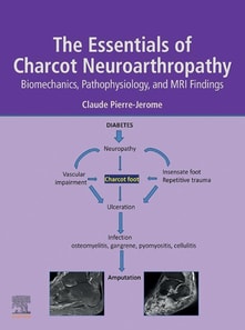 Essentials of Charcot Neuroarthropathy