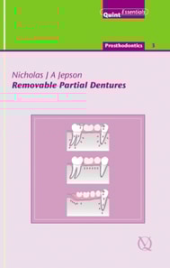 Removable Partial Dentures