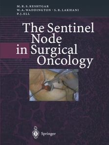 Sentinel Node in Surgical Oncology