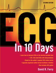 ECG in Ten Days: Second Edition
