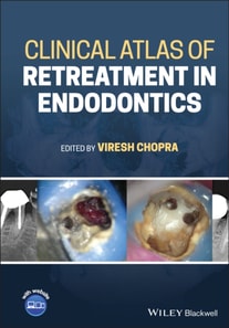 Clinical Atlas of Retreatment in Endodontics