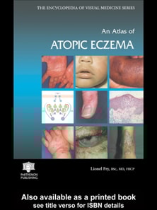 Atlas of Atopic Eczema