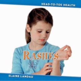 Rashes