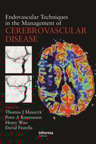 Endovascular Techniques in the Management of Cerebrovascular Disease